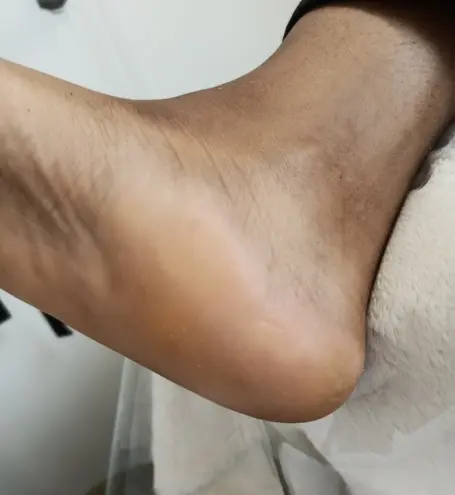 Foot Spa For dry heels