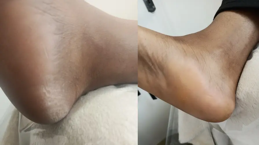 Foot Spa