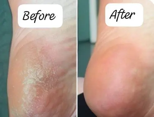 Foot Spa